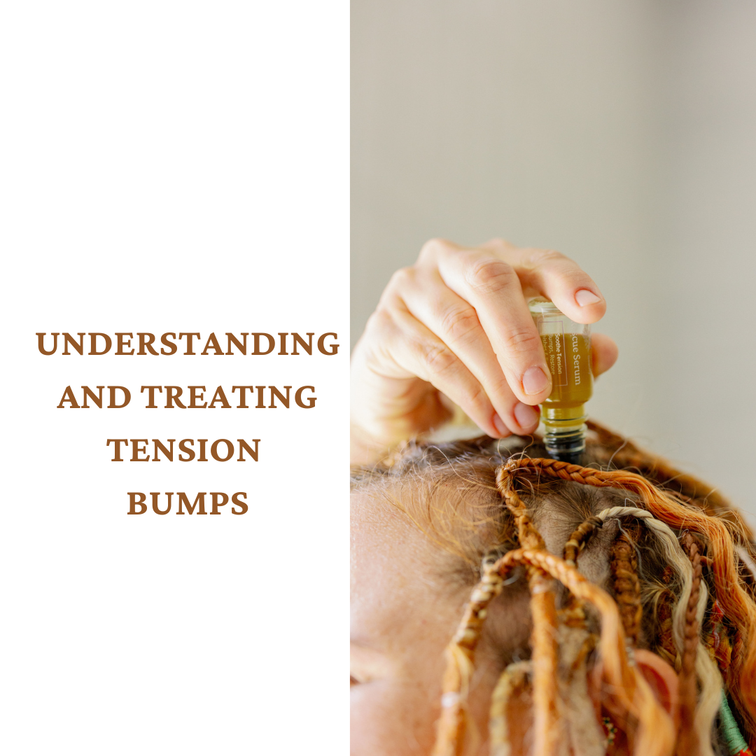 Understanding And Treating Tension Bumps