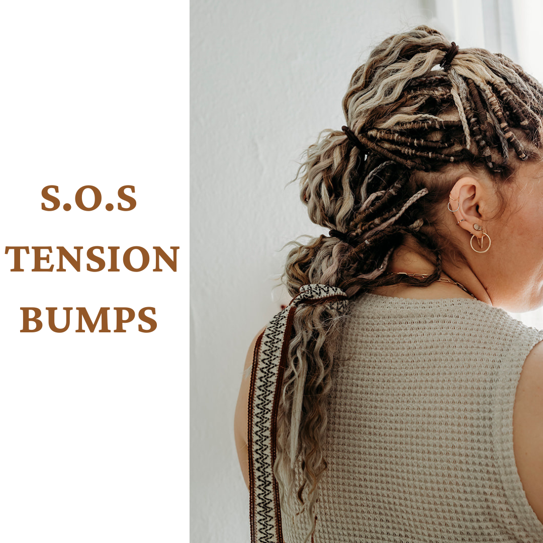 Dreadlock Tension Bumps Explained & How to Treat Them